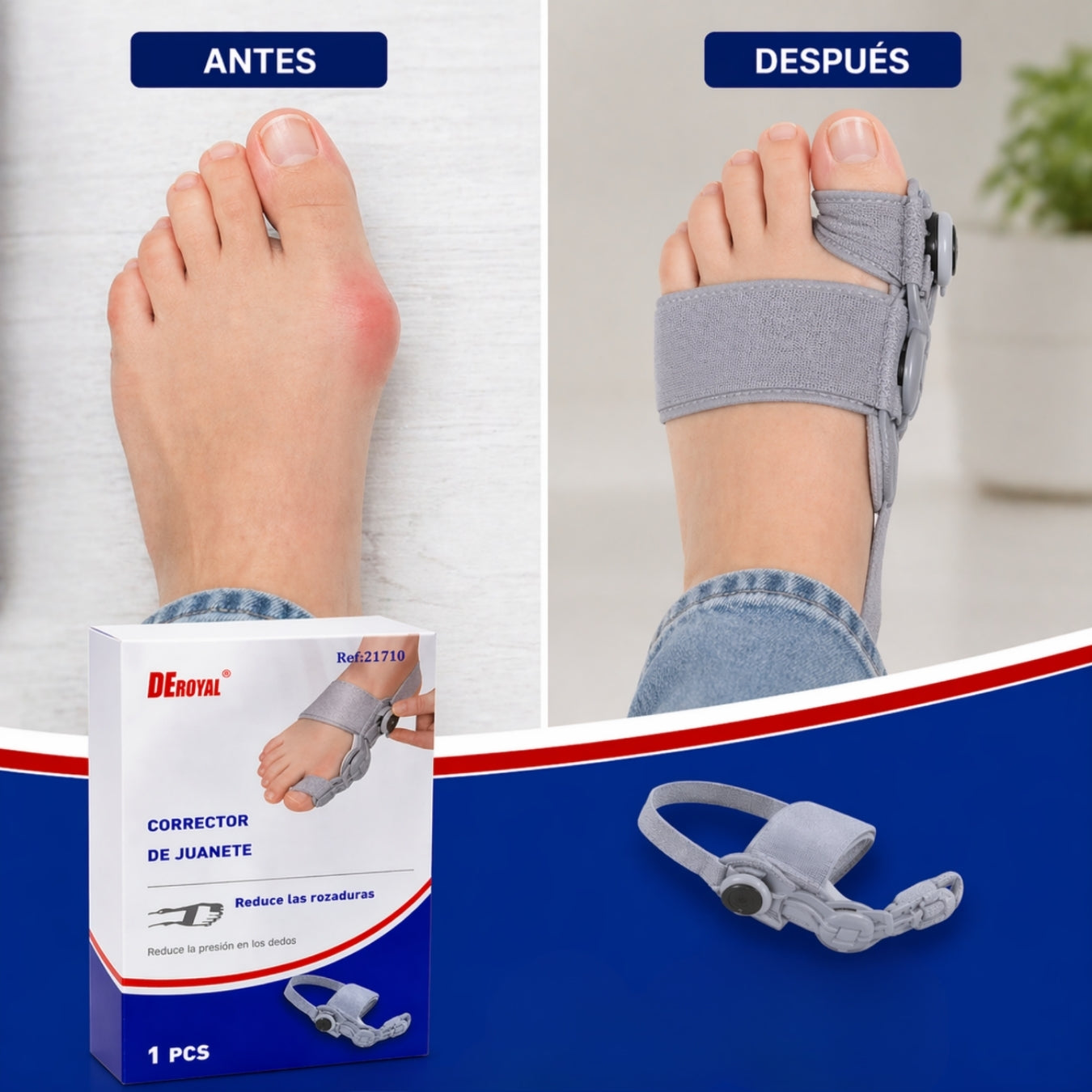 2x1 CORRECTOR DE JUANETES AJUSTABLE | ALIVIPIE™