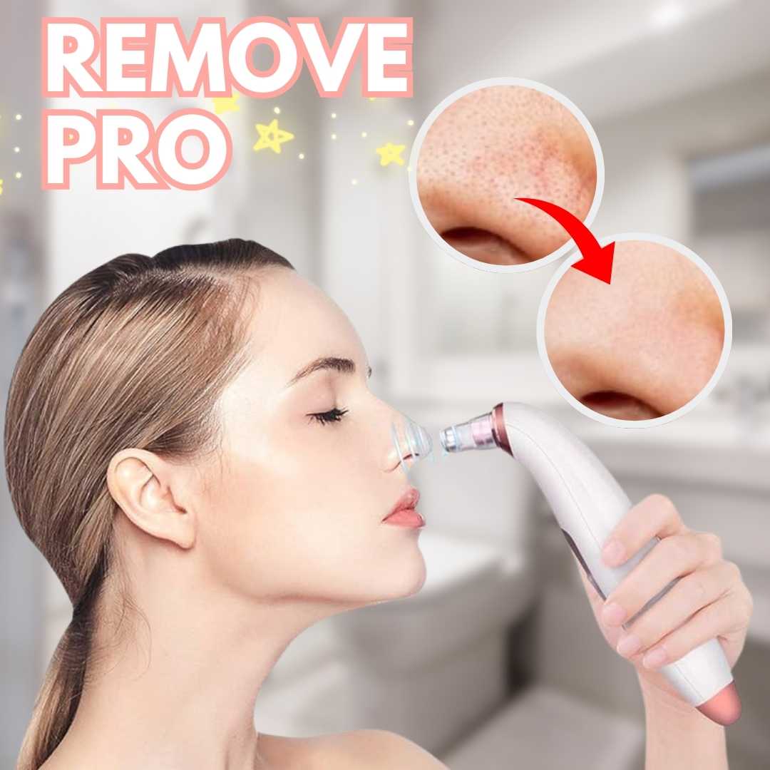 EXCELENTE REMOVEDOR DE PUNTOS NEGROS CON BATERIA DURADERA | REMOVE PRO™