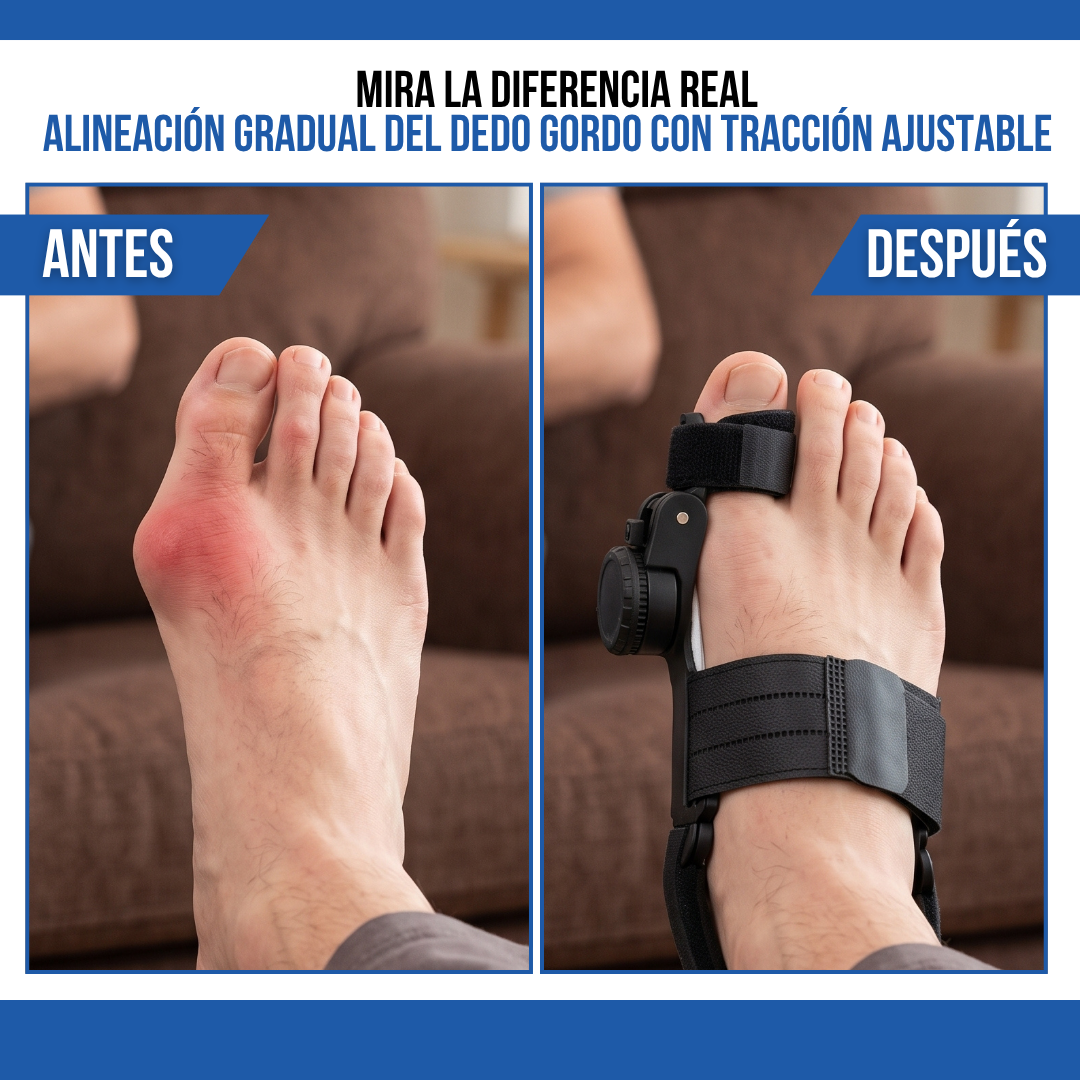 CORRECTOR DE JUANETES ALIVYA™