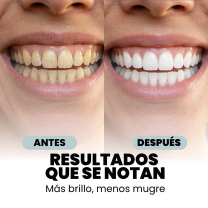 CEPILLO DE DIENTES ULTRA SÓNICO | DENTALUX™